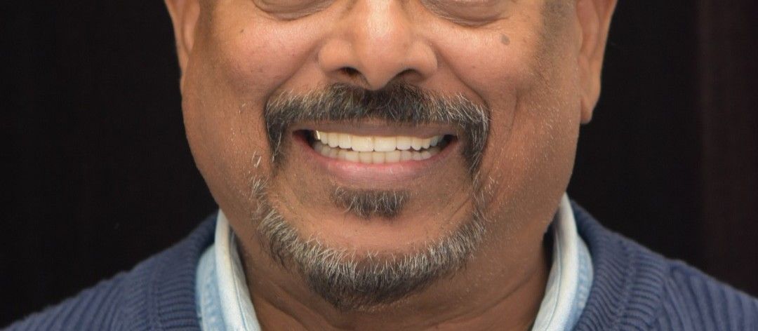 After photo: Same man with white, straight, evenly spaced teeth after dental work