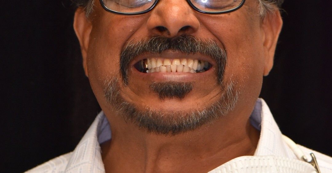 Before photo: Man with discolored and misaligned teeth showing visible gaps and wear